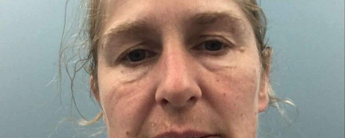 VMB0121 - Det siste året har vist oss hva som er viktig - Elin Mari Skorstad - hvordan man ser ut etter timer med tett maske.jpg